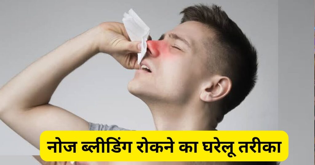 नाक से खून बहने का इलाज