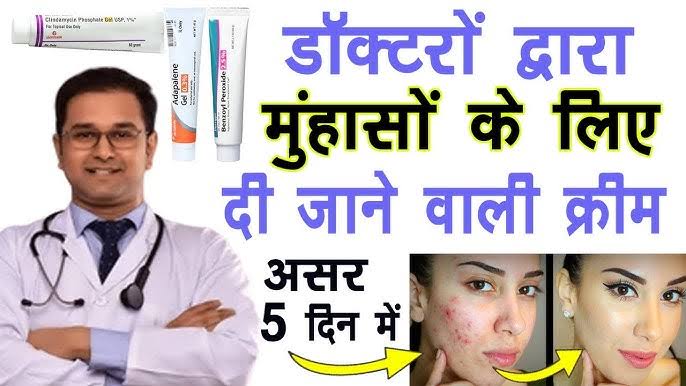 Best 5 Acne Removal Dr Recommended Creem India